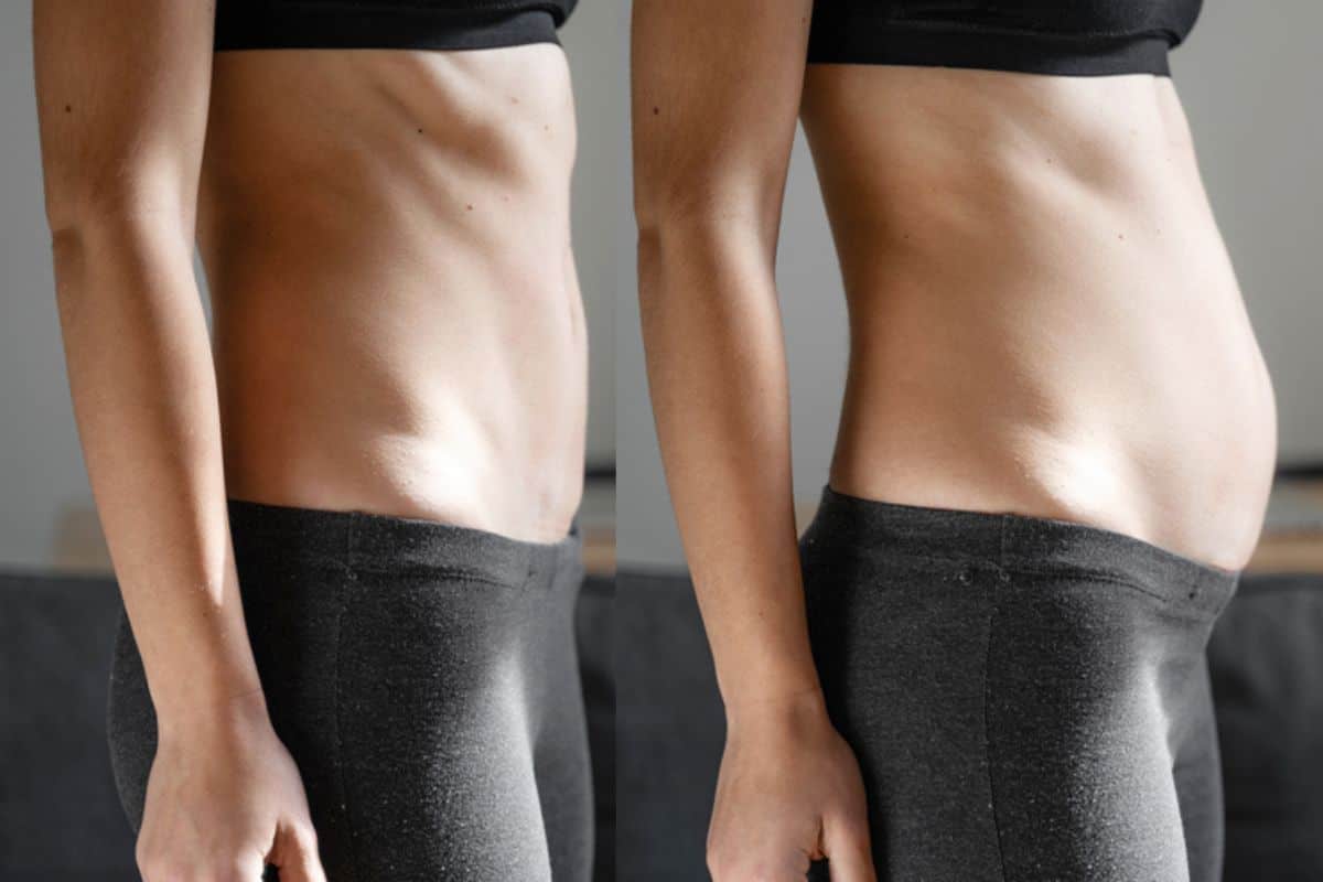 How long does diastasis recti take to improve Greater London (Greenwich)?
