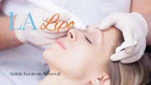 Woman receiving Actinic Keratosis Removal Treatment Greater London (Greenwich)