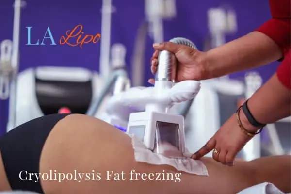 women getting fat freezing Greater London (Greenwich)