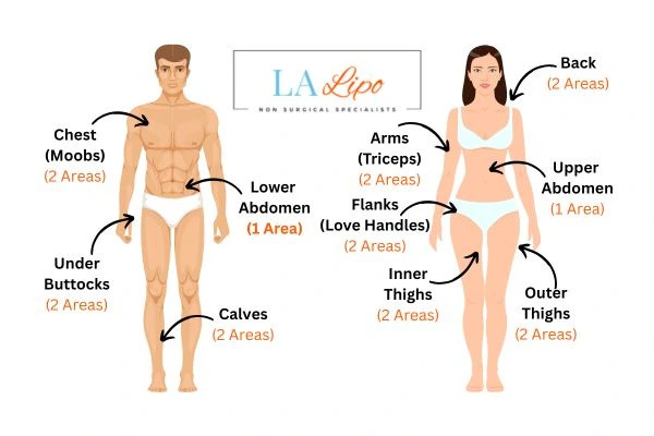 LA LIPO Cryolipolysis Areas Greater London (Greenwich)