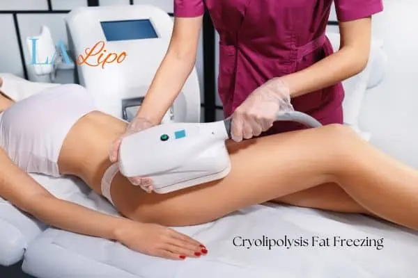 Woman receiving coolsculpting Greater London (Greenwich) treatment on her thighs