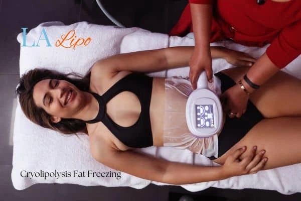 woman getting cryolipolysis Greater London (Greenwich)