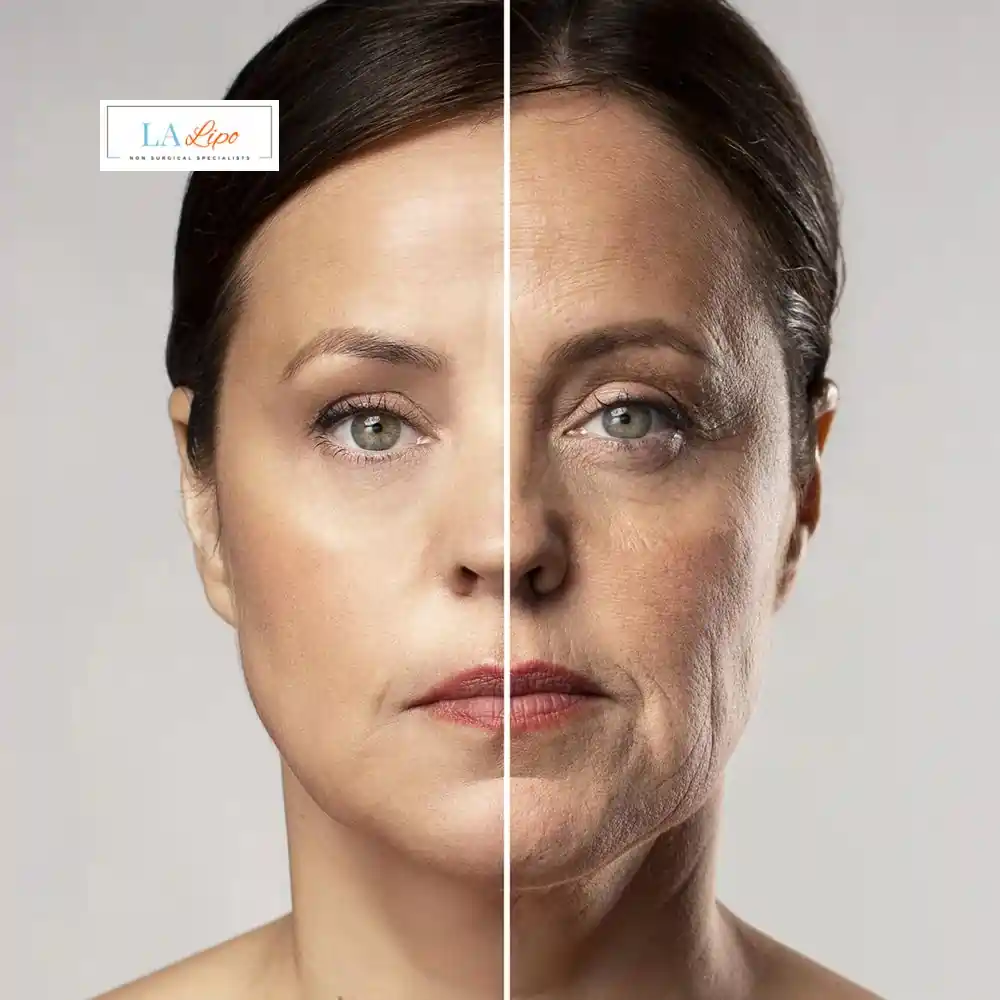 How Can You Tell If Non-Surgical Skin Tightening Is Right for You Greater London (Greenwich)?