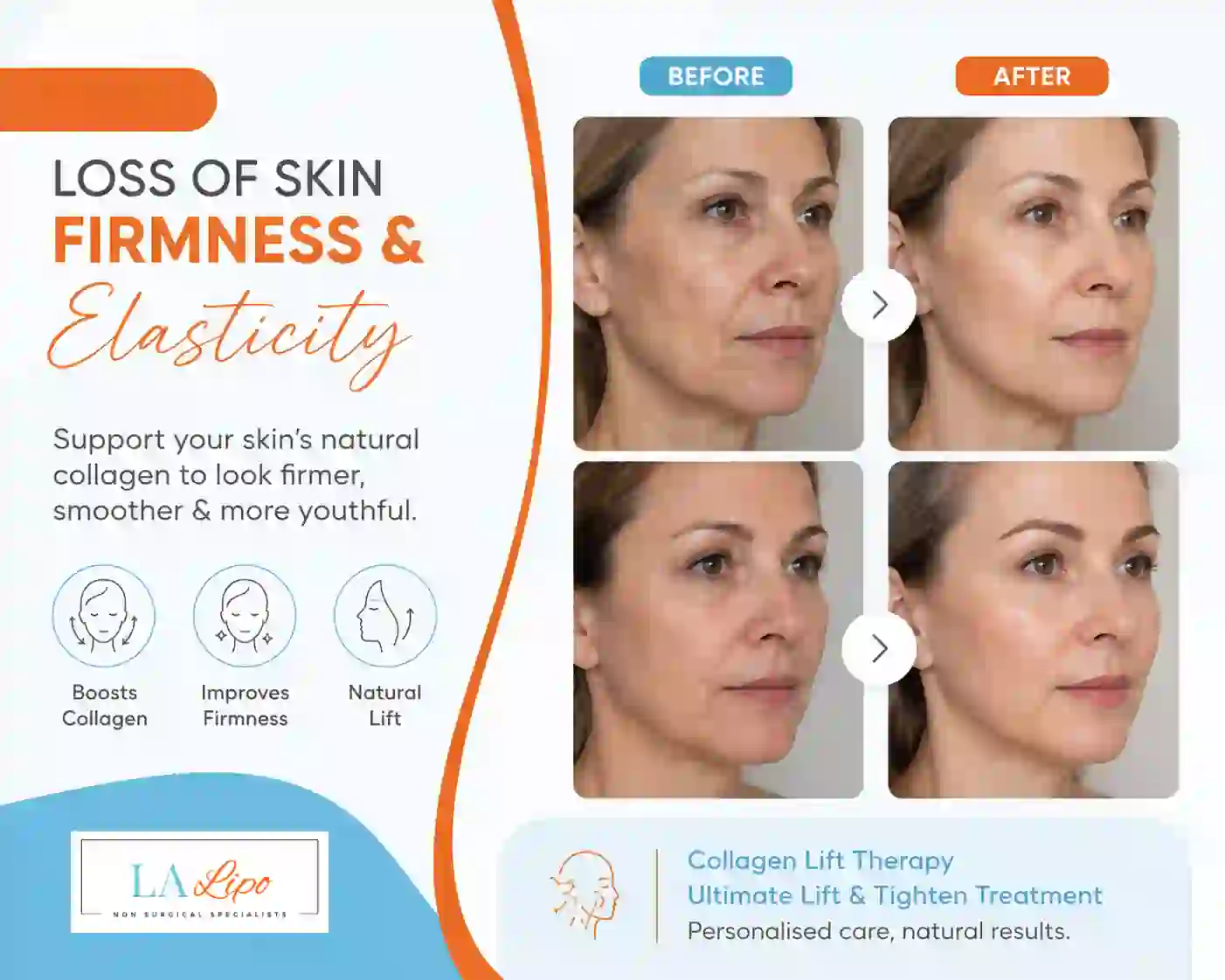 Sign #7: Loss of Skin Firmness and Elasticity Greater London (Greenwich)