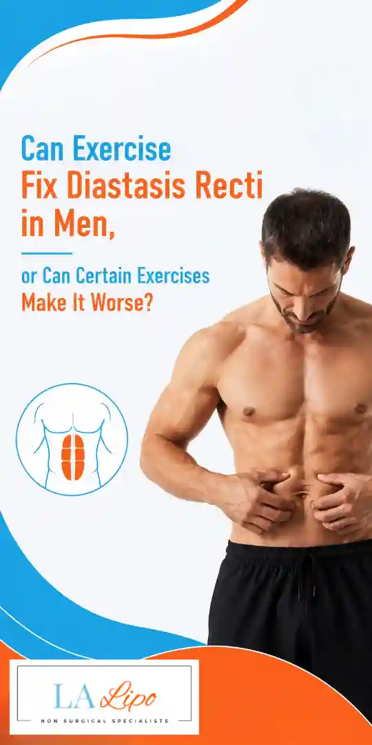 Can Exercise Fix Diastasis Recti in Men, or Can Certain Exercises Make It Worse Greater London (Greenwich)?